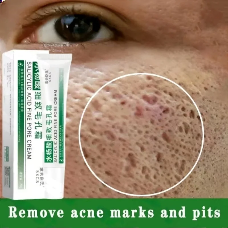 Crema limpiadora de poros de á - Korean Skincare Routine reseña y precio